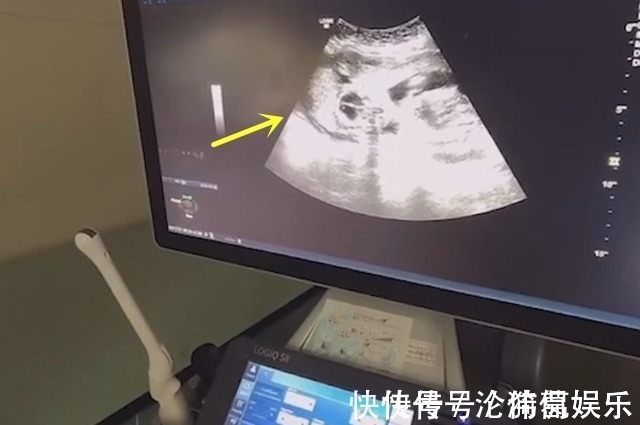 二胎|男孩哭着求妈妈留下二胎,每逢产检必到场,过目检查结果后才放心