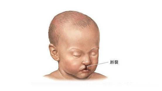 樟脑丸|孕5个月查出胎儿畸形,医生:身上味不对!4种味道孕妈不能沾