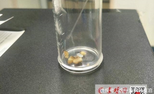 家长请注意!幼儿误吸入瓜子被拖延,致病情危重转入ICU