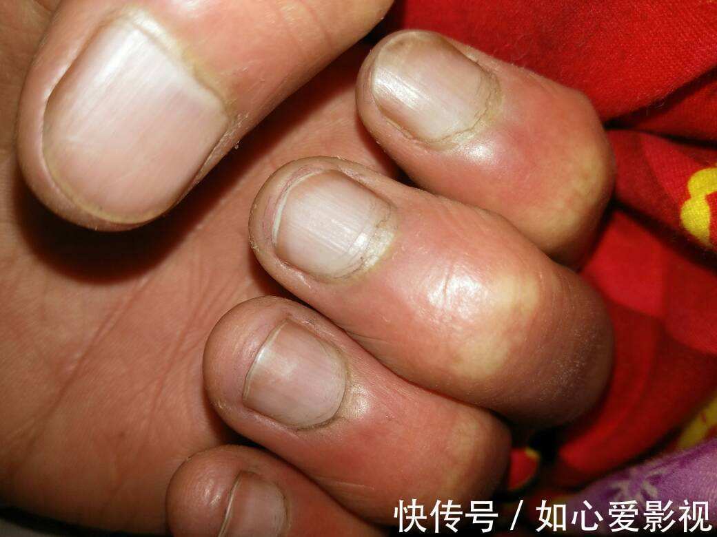 患处|治疗皮肤病的经典秘方！看看有您需要的吗？太难找，好好收藏！