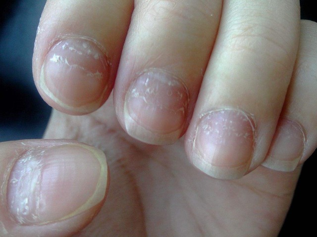 肠胃|消化科医生养胃很简单，3种“零食”，你若爱吃，胃自然好起来