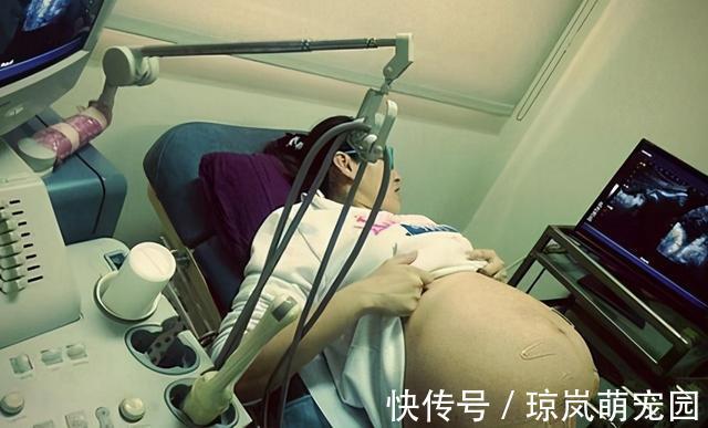 怀孕|怀孕8个月，产检被告知多条腿，娃生下全家乐了，网友反应很直接