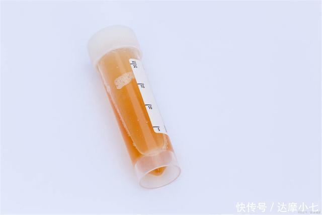 好帮手|首次公布:有一种方法,是降血糖、降血脂的好帮手,却经常被忽略