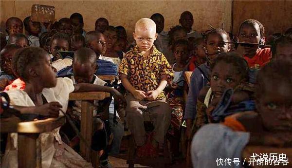 现实版“唐僧”,身处非洲,血液堪比黄金,被警察24小时保护