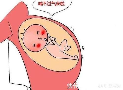 征兆|胎儿与孕妇缺氧的征兆是什么?这样很危险吗?