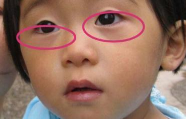 孩子|吃一次7天不消化,很多父母天天喂娃吃,儿科主任:溺爱毁掉孩子