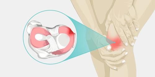 运动损伤|「半月板」最怕的一个动作，分分钟加速它的“报废”！