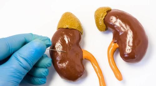  肾功能|注意：2件事伤肾还会升尿蛋白，不重视小心被肾衰竭盯上