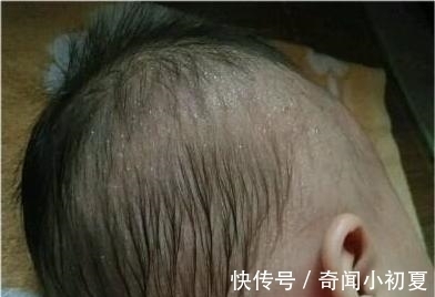 宝宝|小宝宝为什么会出现枕秃?