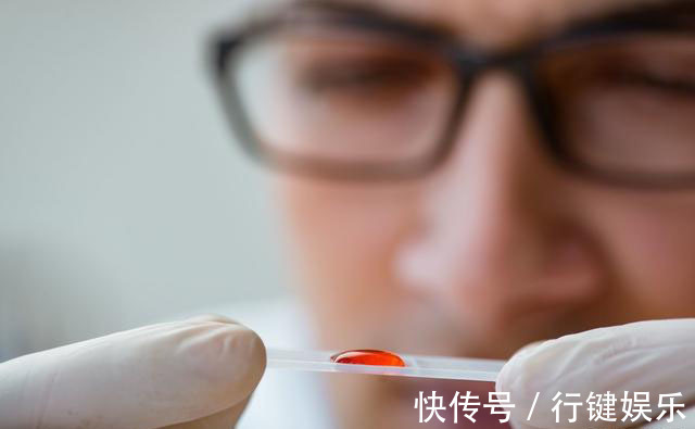 中华医学会|三个月前体检健健康康,三个月后诊断晚期肺癌,已经遇到不止一例