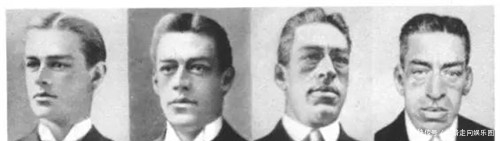 极端|生于侏儒，死于巨人，他是世界上唯一一个患有两种极端病症的人