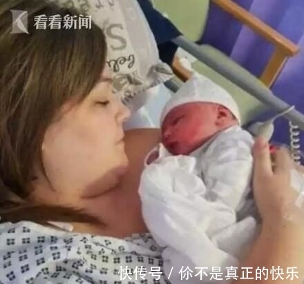 柔伊|医生从妈妈肚子里取出一个肉球！网友：这是哪吒啊