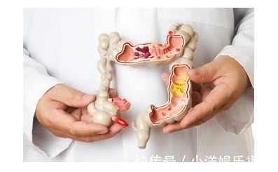 症状|身上出现以下症状是肠癌，却被误认为是痔疮，及早治疗