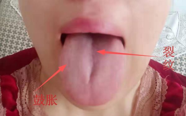 头晕|头晕,耳鸣,脸上长斑,爱生气,3步调理法,问题统统都赶跑!