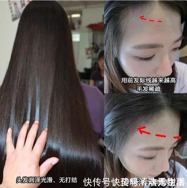 发质|头发刚浸湿就抹洗发水怪不得头屑还掉发!教你正确的洗发方式!