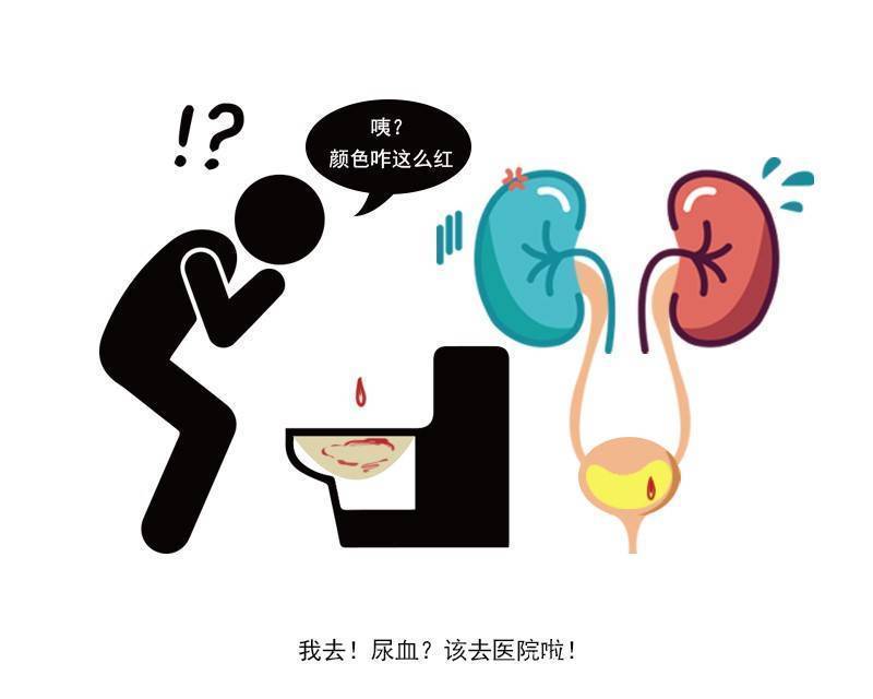 尿路梗阻|肾结石找上你时,身体或有6种表现,及时检查,以免引发尿毒症