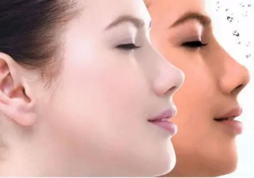 女人|一白遮百丑!这些食物能帮助皮肤变白,还能变瘦,女人不妨多吃