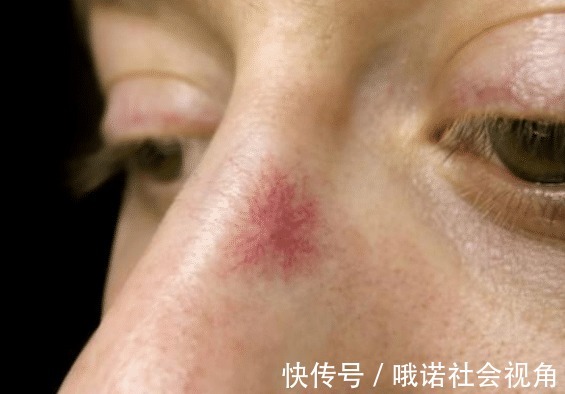 养肝|养肝“冠军”找到了,不是萝卜,敞开吃,肝脏或许健壮如“牛”