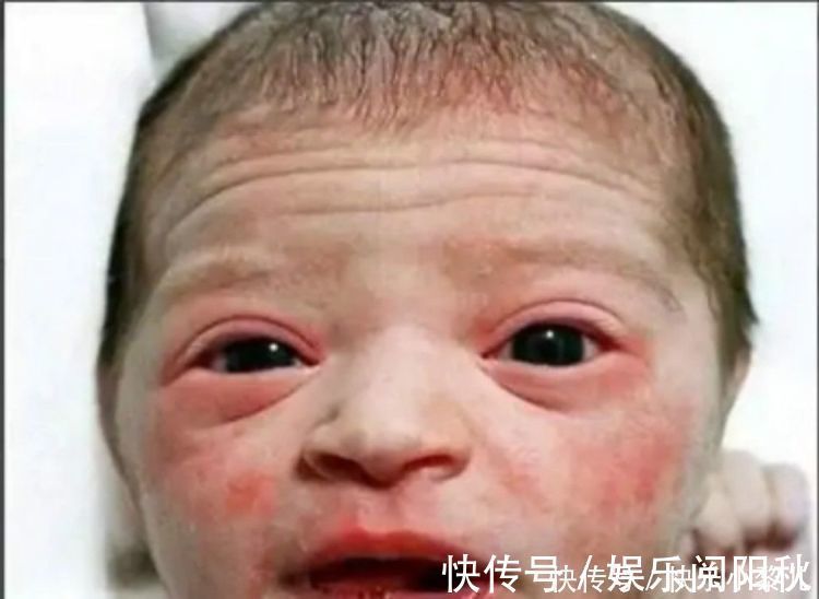 护士|''丑娃''出生遭全家嫌弃,护士却说漂亮,3个月后家人纷纷道谢