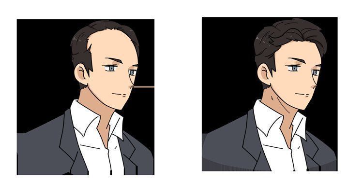 移植|揭秘植发全过程:一次植发能维持多久?哪些人不适合做?有多贵?