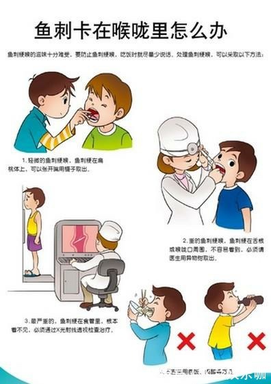 孩子|四岁宝宝被鱼刺卡喉咙，母亲用这个方法取出刺，大夫连连夸赞
