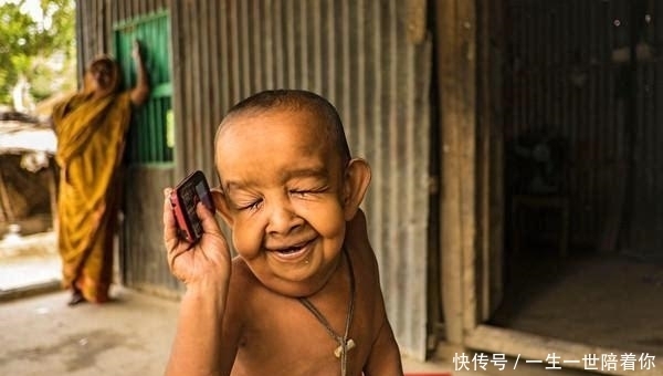 男孩|印度4岁男孩面容如90岁老翁,3个月大牙齿长全