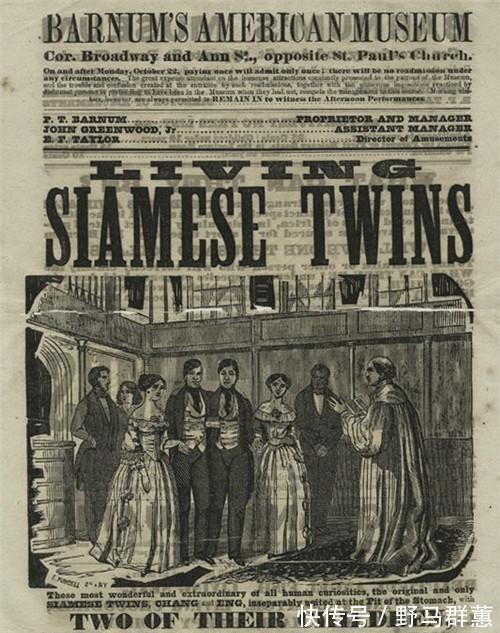 兄弟|这对华裔连体兄弟靠表演成名,娶了一对姐妹,生了22个孩子