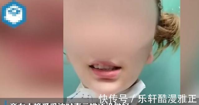 非法行医罪 女子花一万在朋友家做拉皮手术,最终成面瘫,朋友无证被逮捕