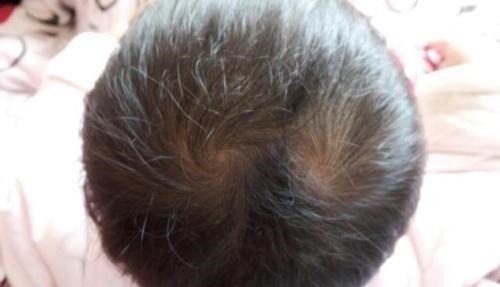 性格|为什么有的孩子头上有2个“旋”有关发旋的误解,你知道多少!