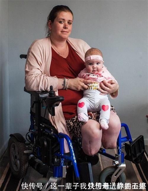 孩子|生下孩子醒来却发现自己的腿不见了！这是什么操作！