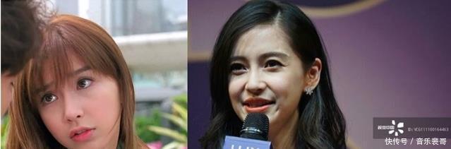 不老女神|还有多少女明星为了变美，而去饮鸩止渴打玻尿酸