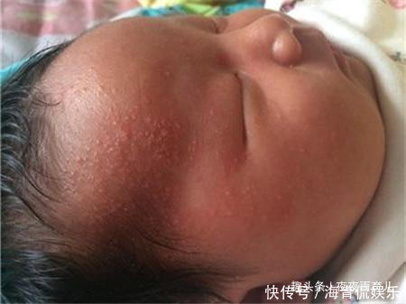 父母|宝宝热出一身痱子!天热,父母能不能给宝宝吹空调
