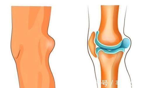 身体|女人绝经后，身体出现3种表现，警惕骨质疏松找已上门，需重视