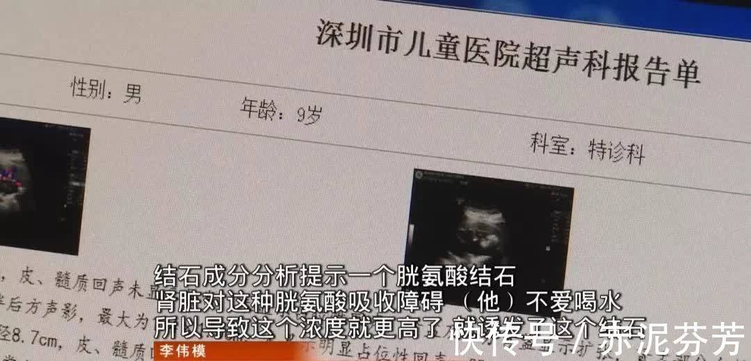 尿血|9岁男孩体内塞了56颗肾结石,只因天天吃这个,很多妈妈还在给孩子喂