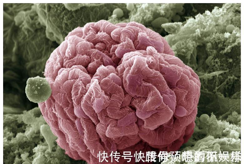 胚胎|刚怀孕就见红怎么办?这些孕早期注意事项要记牢!