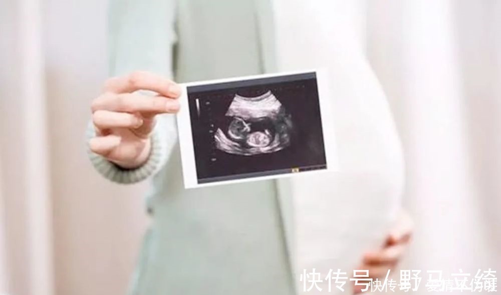 鉴定|一张四维彩超轻松看出胎儿性别,孕妈先别高兴的太早