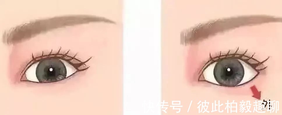 美白针|这5个医美项目虽然很火,但很多医生不建议做!丨科普篇