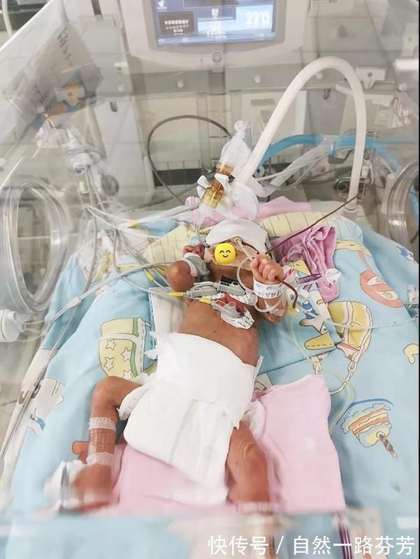 护理|黔南州中医医院:全力抢救 精心护理!家庭参与式护理救治“巴掌大”早产儿!