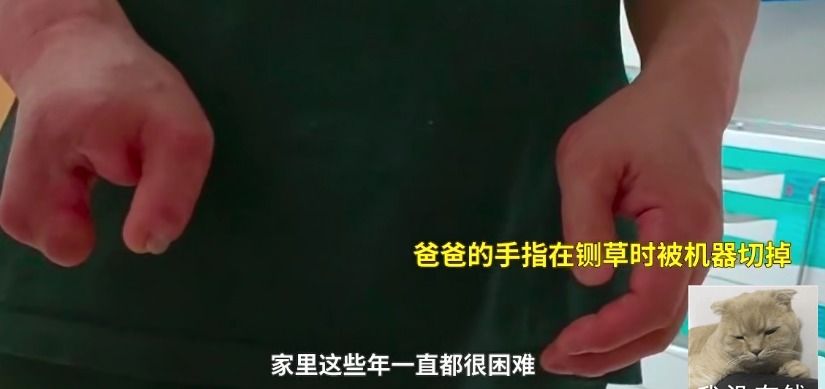 女孩|20岁漂亮女孩患癌对比图曝光,前后判若两人,父母皆是残疾人