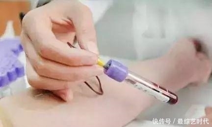 结肠癌|癌胚抗原高了就是得了癌症?不一定吧
