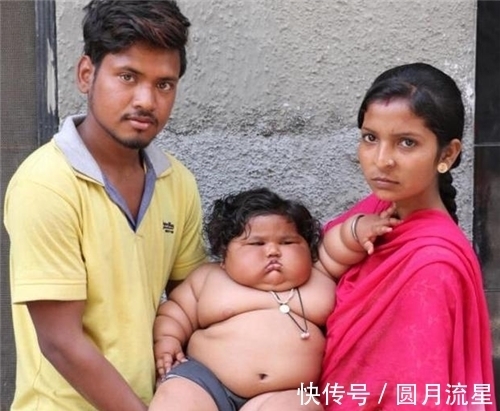 湘雅医学院|印度第一女巨婴:1岁体重45斤,一顿吃2斤米,如今过得怎样