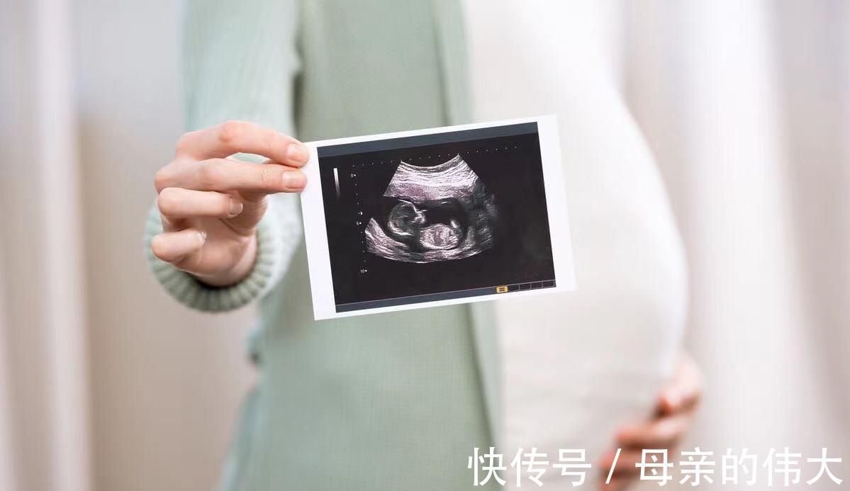 孕期|孕期四维彩超，准妈妈第一次见到宝宝的样子，那些准备你做好没