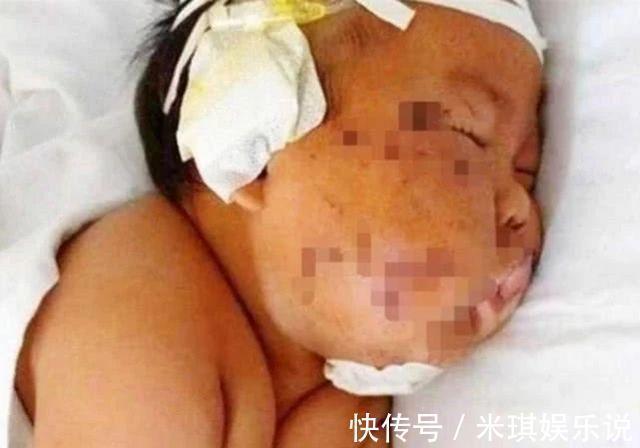 婆婆|四年前,男婴吃奶太用力,小脸被亲妈用剪刀划伤!他现状如何了?
