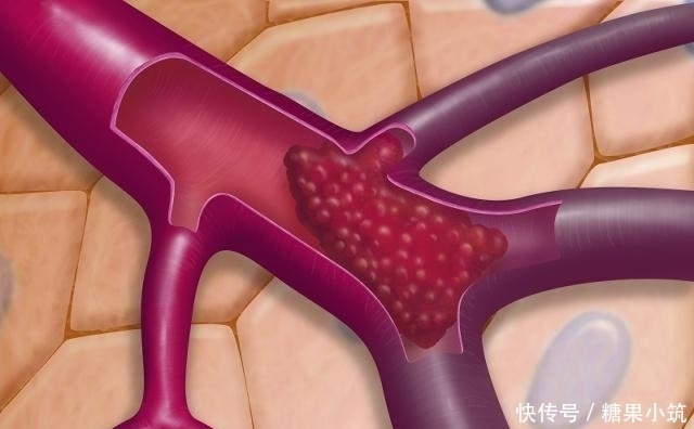  发生|每天喝一杯白酒的人，身体或许悄悄发生3个“可喜”变化，看看吧