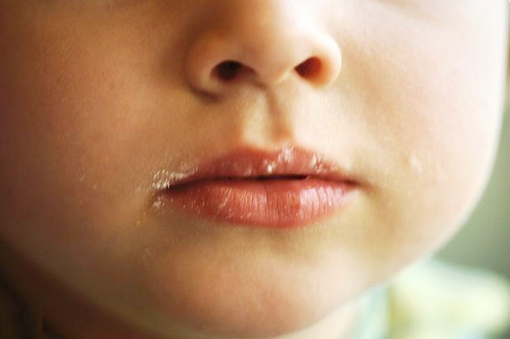 孩子睡觉时有3个现象，说明辅食添加过度，脾胃出现问题了