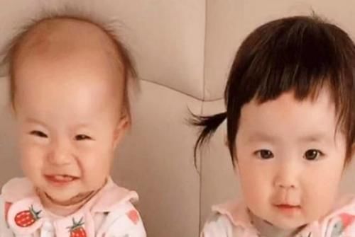 小女儿|双胞胎姐妹从小分开,一个奶奶带一个姥姥带,3年后差距一目了然