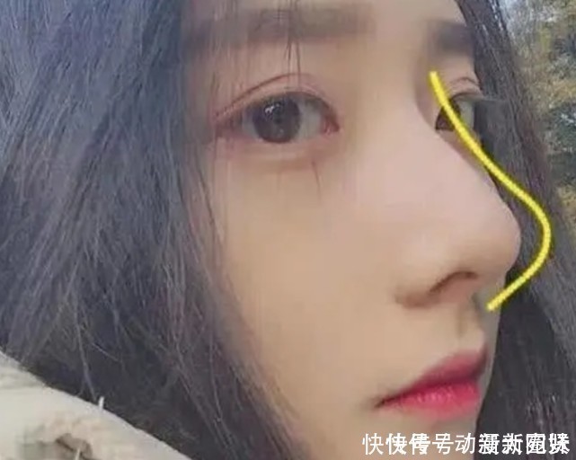 被公认的3种“丑鼻子”，中了颜值不会太高，没中的小仙女偷笑吧