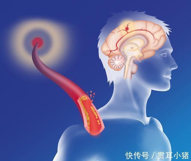 离谱|每天喝二两白酒和滴酒不沾的人,谁更易患癌你错的很离谱