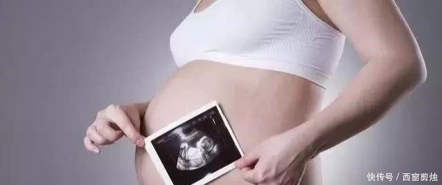 顺产|顺产快的原因除了走路多,还有这些,都有的恭喜你可能会“秒顺”!