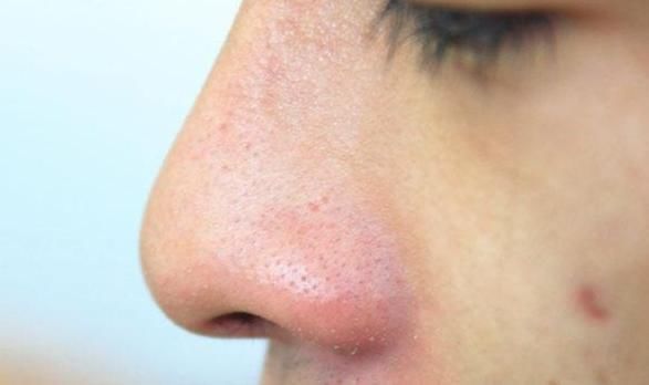 掉头发|女人走向衰老,身上会有六种表现,你若没有,说明很年轻